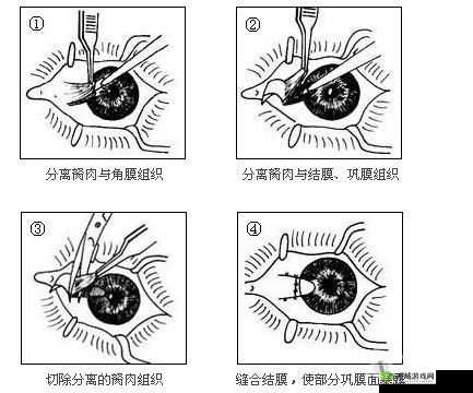 获得超级胬肉系统怎么办：寻求专业帮助