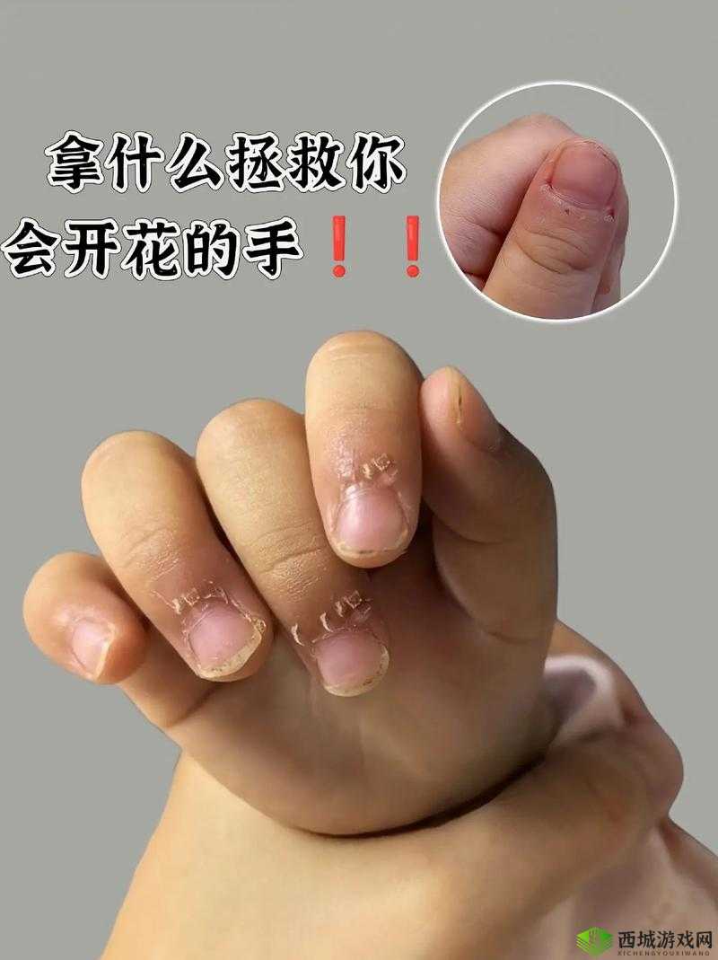 宝宝：才三根手指，就这么疼