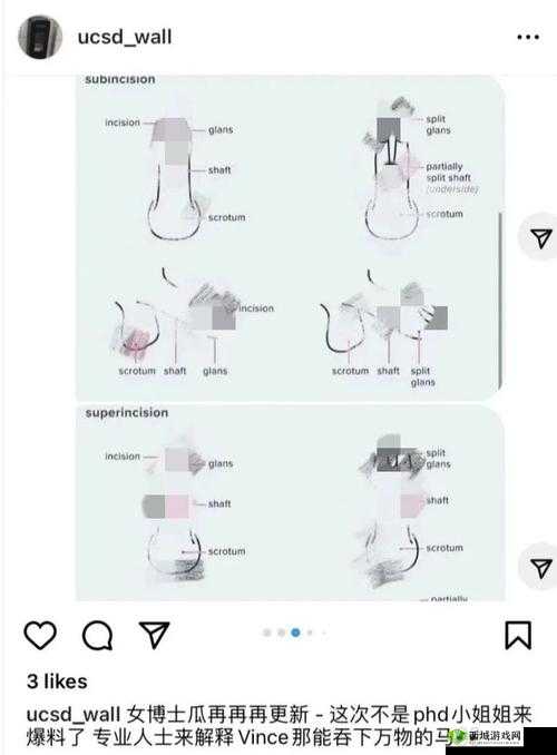 羊水门?什么是羊水门?带你了解人进羊水门的神秘过程是怎样的